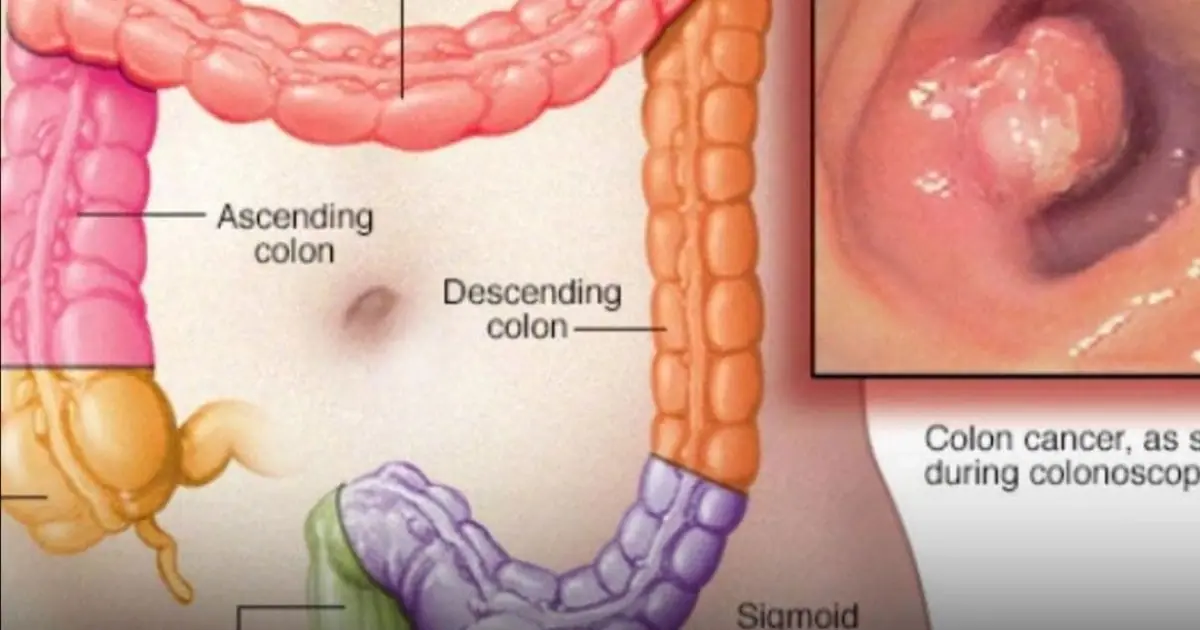 Do NOT ignore these signs…. especially #14