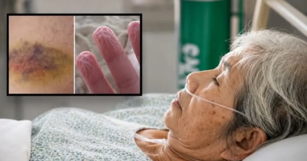 One Year Before Death? Experts Explain the Warning Signs the Body May Show