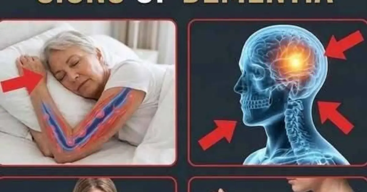 10 Early Signs of Dementia You Should NEVER Ignore!