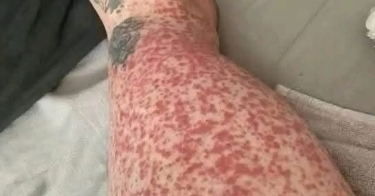 Here are the consequences of sleeping with… See more