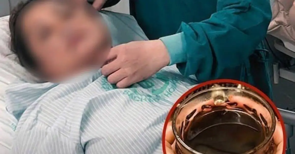 54-Year-Old Woman Suffers Sudden Stroke Overnight: Doctors Warn About Two Popular Drinks Before Bed