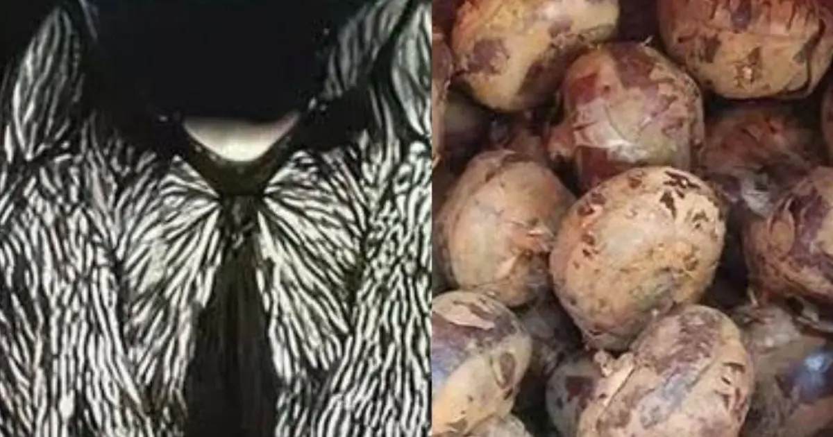 One Bite Could Introduce Thousands of Parasites: The Hidden Risk of Eating Raw Water Chestnuts