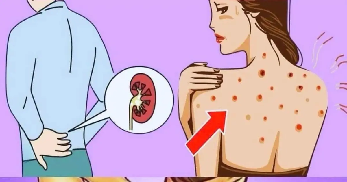 10 Warning Signs Your Kidneys May Be Struggling — Symptoms You Should Never Ignore