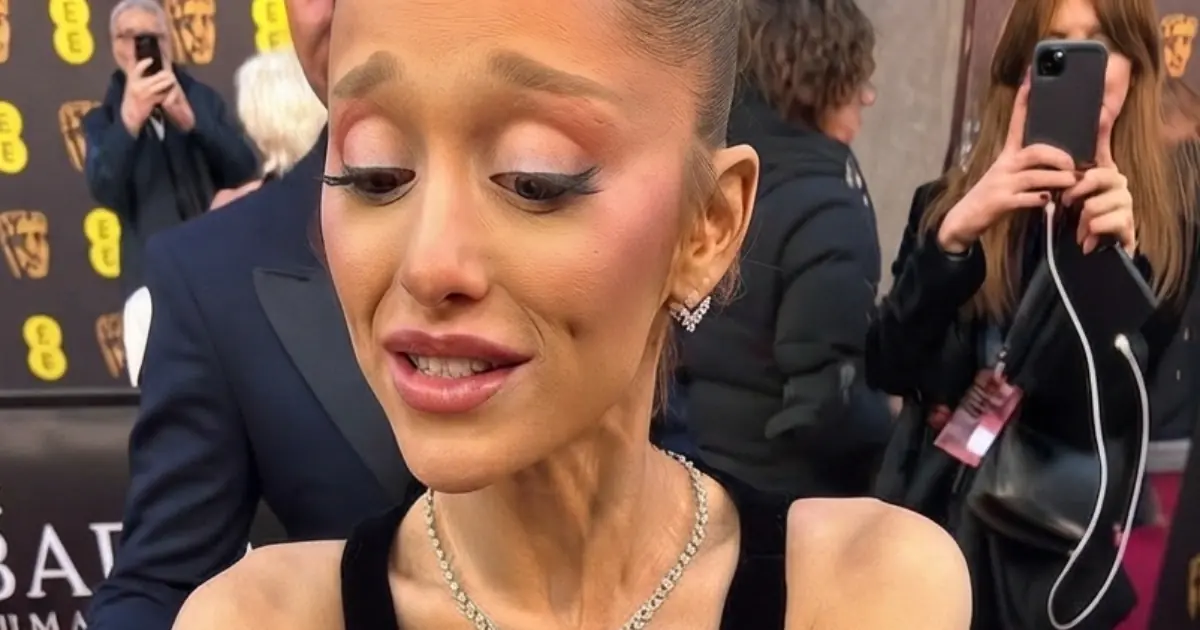 Ariana Grande Opens Up About a Recent Health Concern — Her Update Is Getting Attention…