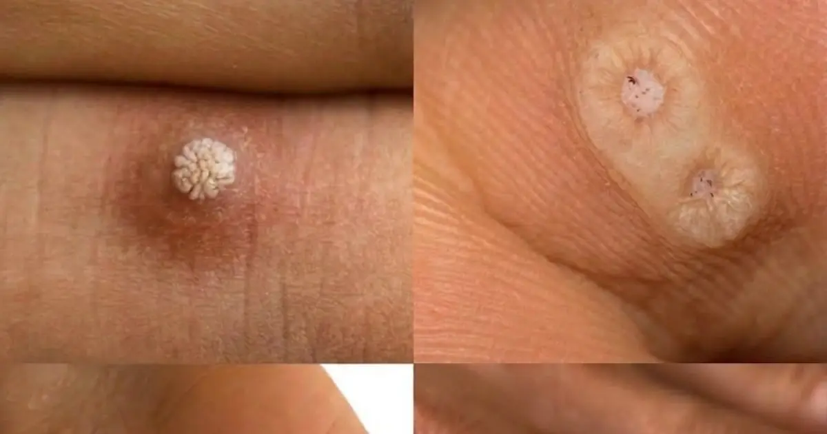 WARNING: Don’t Ignore This! Here’s What You Need to Know…