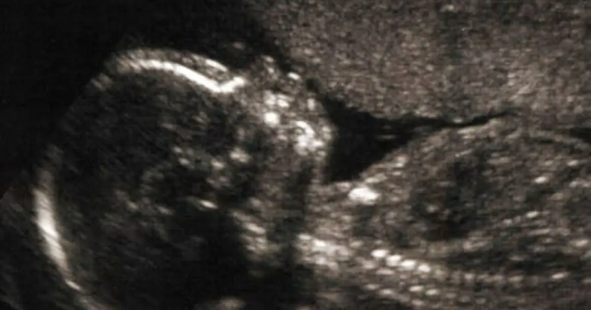 Scientists May Have Found One Important Clue Behind Autism Development