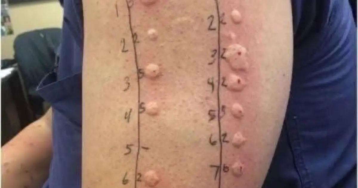 These are the consequences of sleeping with the… See more