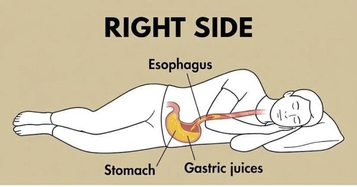 Remember that if you always sleep on your right side, you… Read more