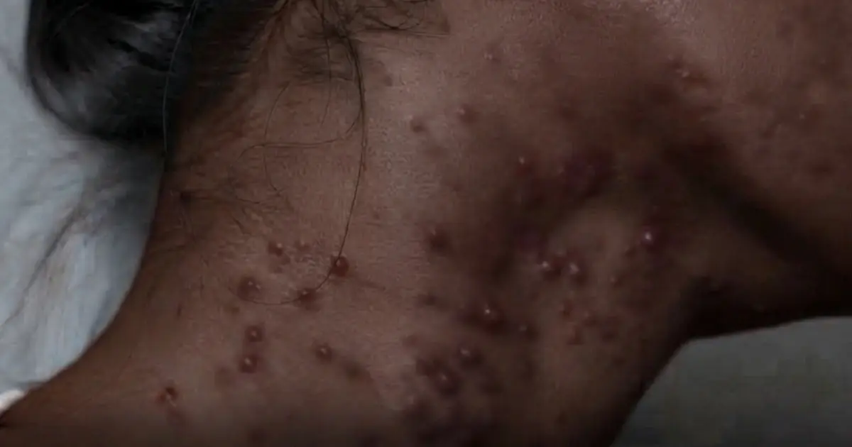 . Do You Sleep With a F...? Here’s What Could Happen While You Sleep