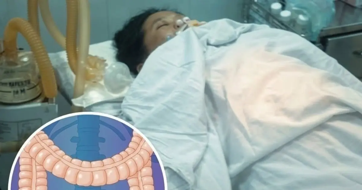Young Engineer Diagnosed With Stage 3 Colon Can.cer at Just 25 After Ignoring One Warning Sign