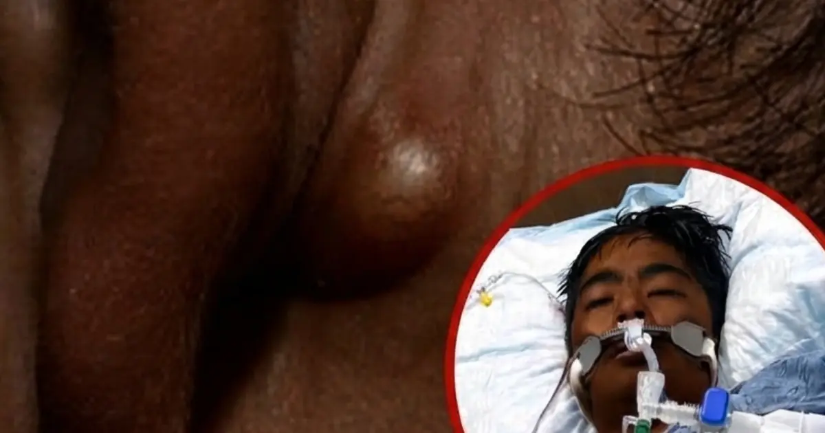 20-Year-Old Man Thought These Two Nighttime Symptoms Were Nothing — Until Doctors Found the Cause