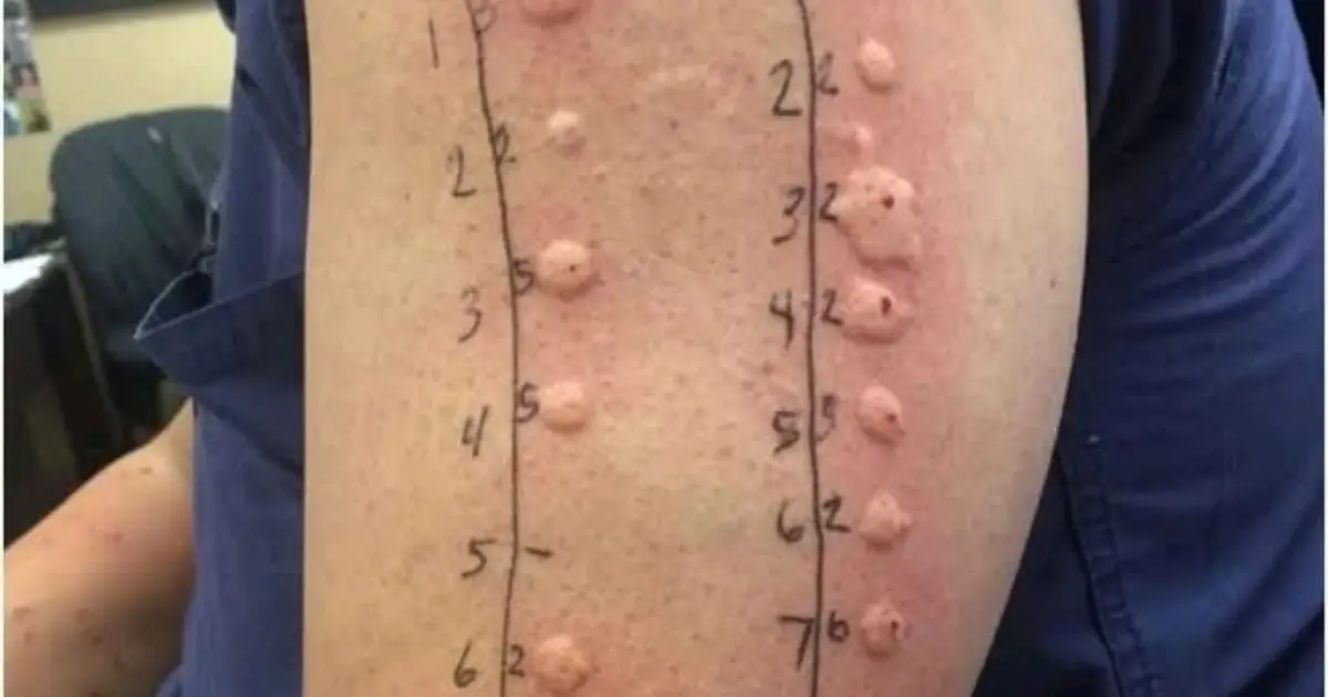 These are the consequences of sleeping with the… See more