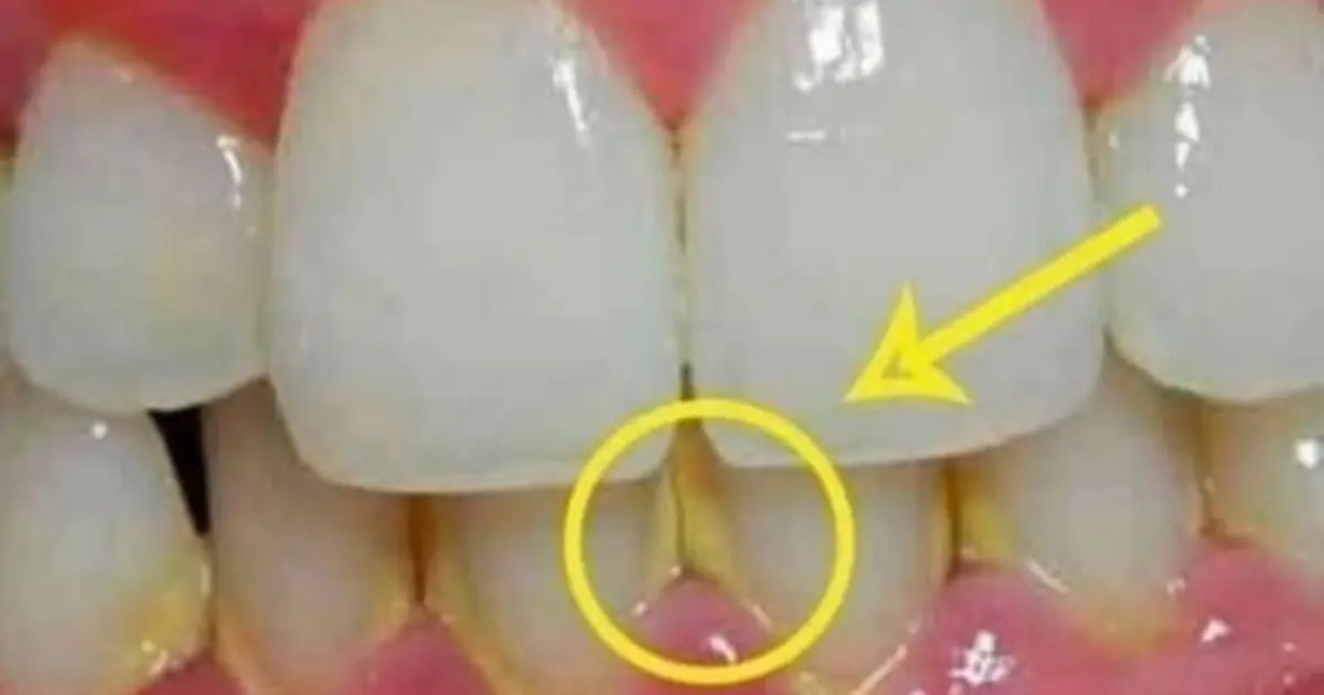 Want a Cleaner Smile? This 5-Minute Routine May Help Reduce Plaque Buildup