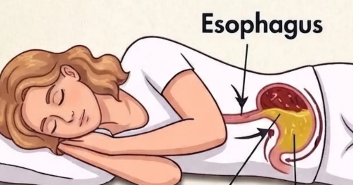 Doctors Have a Reason for Recommending One Sleeping Side Over Another — And It’s Not Just About Comfort