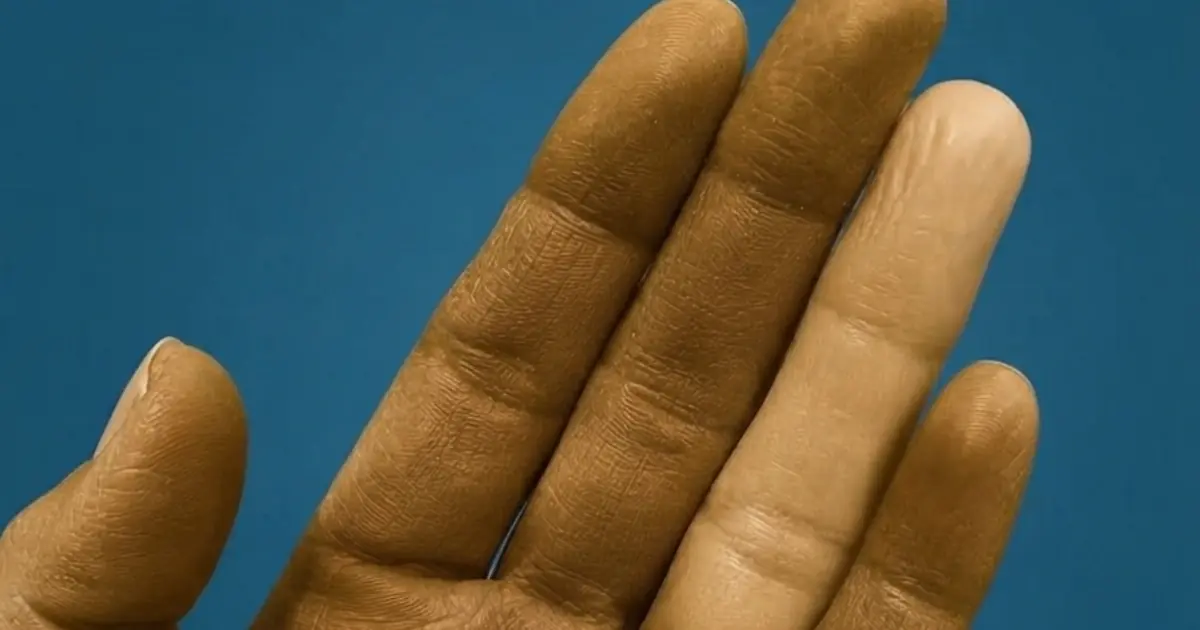 Wake Up in the Middle of the Night With a Cold, Numb Finger? Don’t Ignore This Possible Explanation…