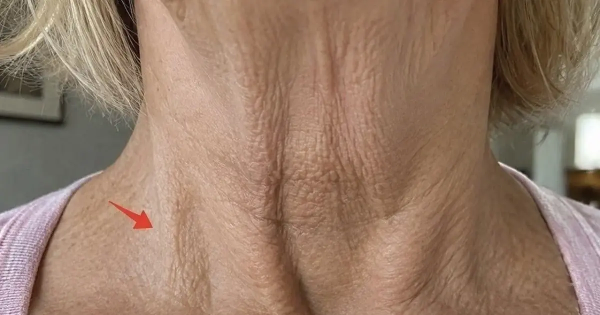 Why Is Your Neck Starting to Sag? Understanding the Most Common Causes