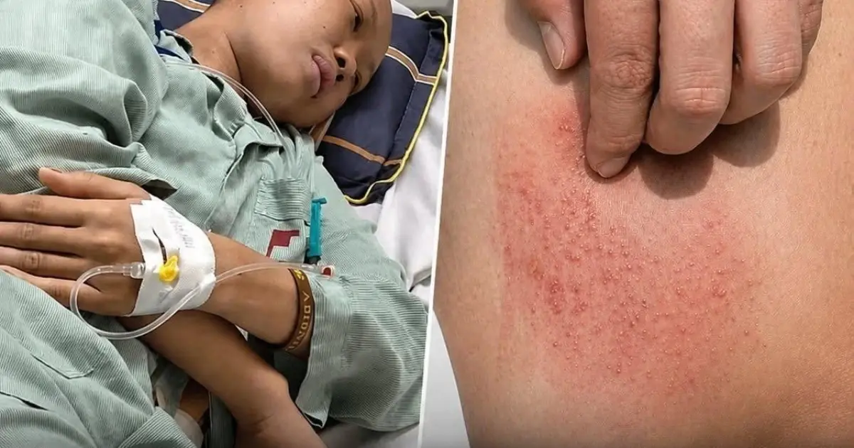 Watch for 2 Unusual Odors, 2 Types of Itching, and 2 Early Warning Signs.