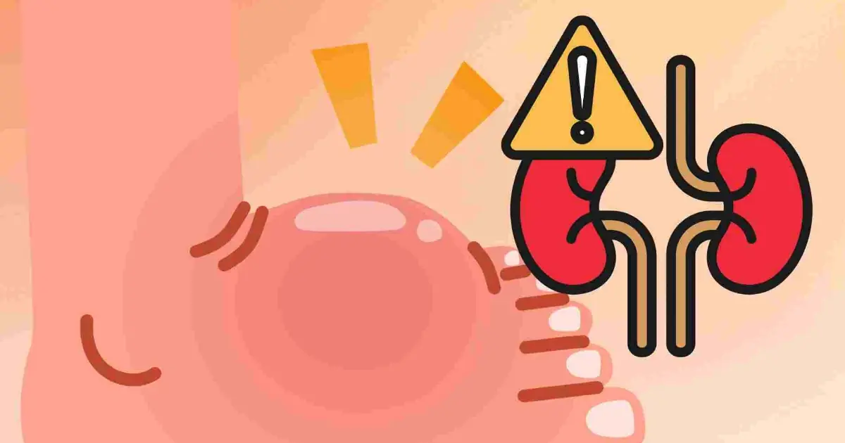 Are Your Kidneys Trying to Warn You? 12 Body Changes You Should Know