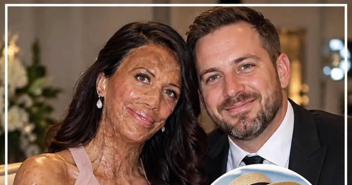 Beyond the Surface: The Extraordinary Love Story of Turia Pitt and Michael Hoskins