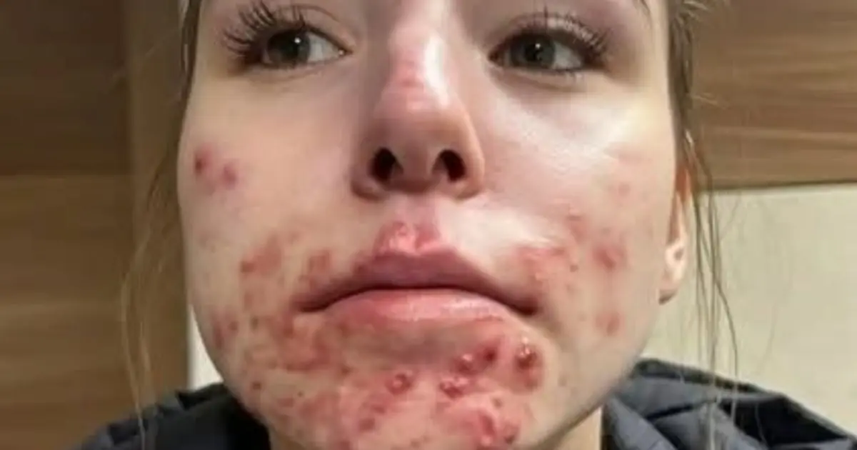 She Woke Up With These Unexpected Skin Changes But What Caused Them?
