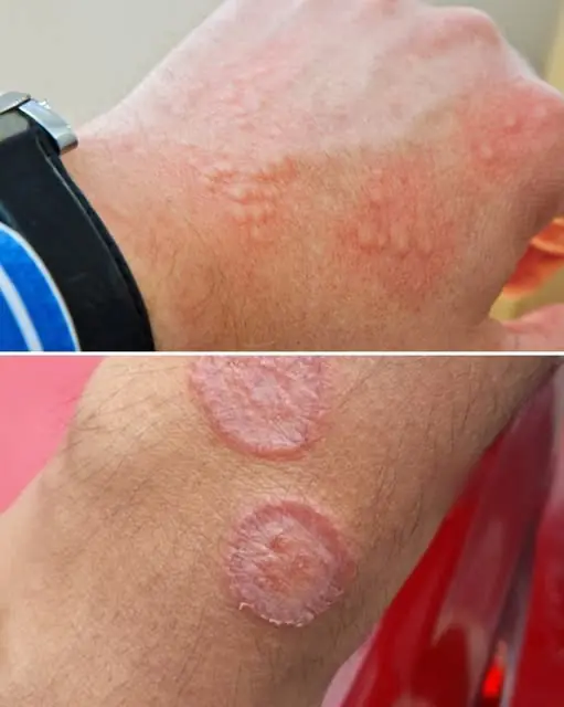 These Skin Changes May Be Trying to Tell You Something — Signs You Shouldn’t Ignore