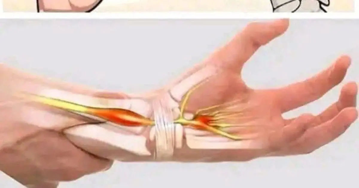 If your HANDS fall asleep it's a clear sign that you have can...