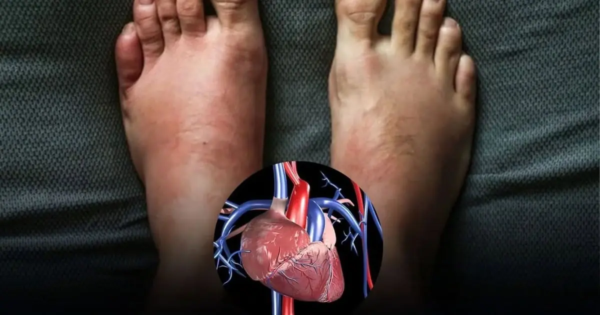 One Month Before a Heart Attack: 7 Warning Signs Your Body May Show