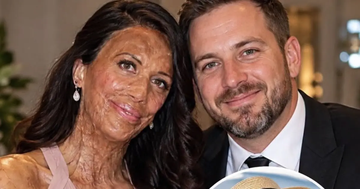 I Married Her Soul, Not Her Appearance”: Turia Pitt and Michael Hoskin’s Extraordinary Story of Love, Loyalty, and Resilience