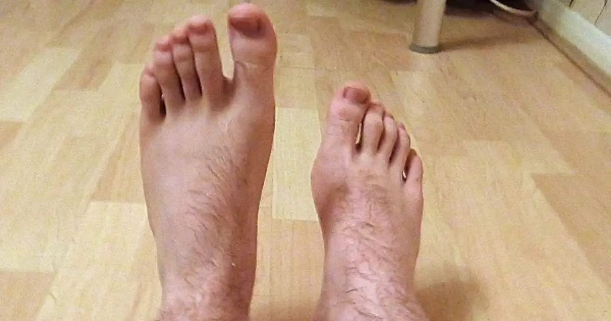 Unexpected Foot Changes Could Be Health Clues - Here’s What to Watch For