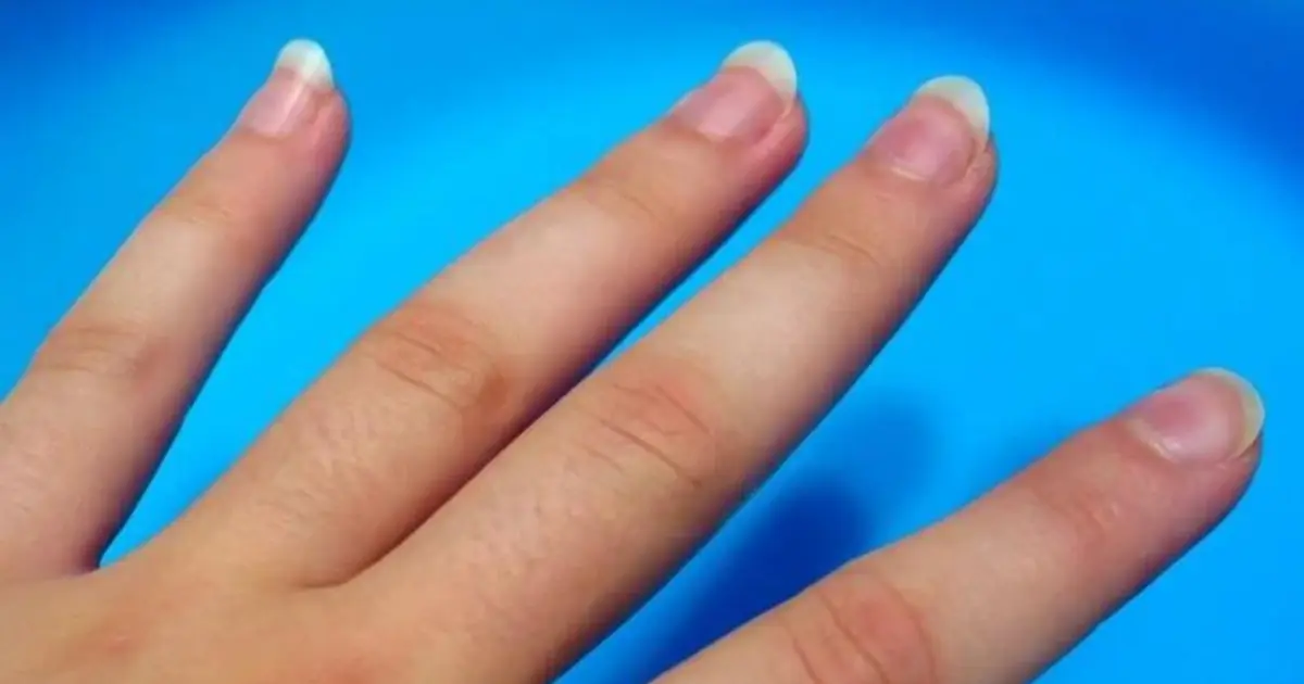 Don’t Ignore These Changes in Your Fingers - They Could Be Linked to Lung Problems