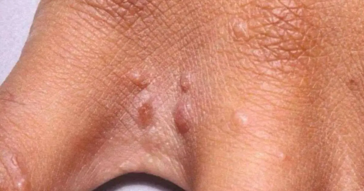 Your Skin May Be Telling You Something: What Tiny Red Dots Could Mean