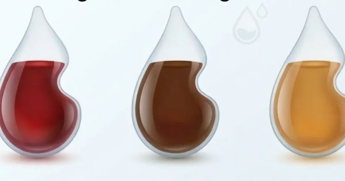 From Pale Yellow to Darker Shades: What Could Your Urine Color Be Telling You?