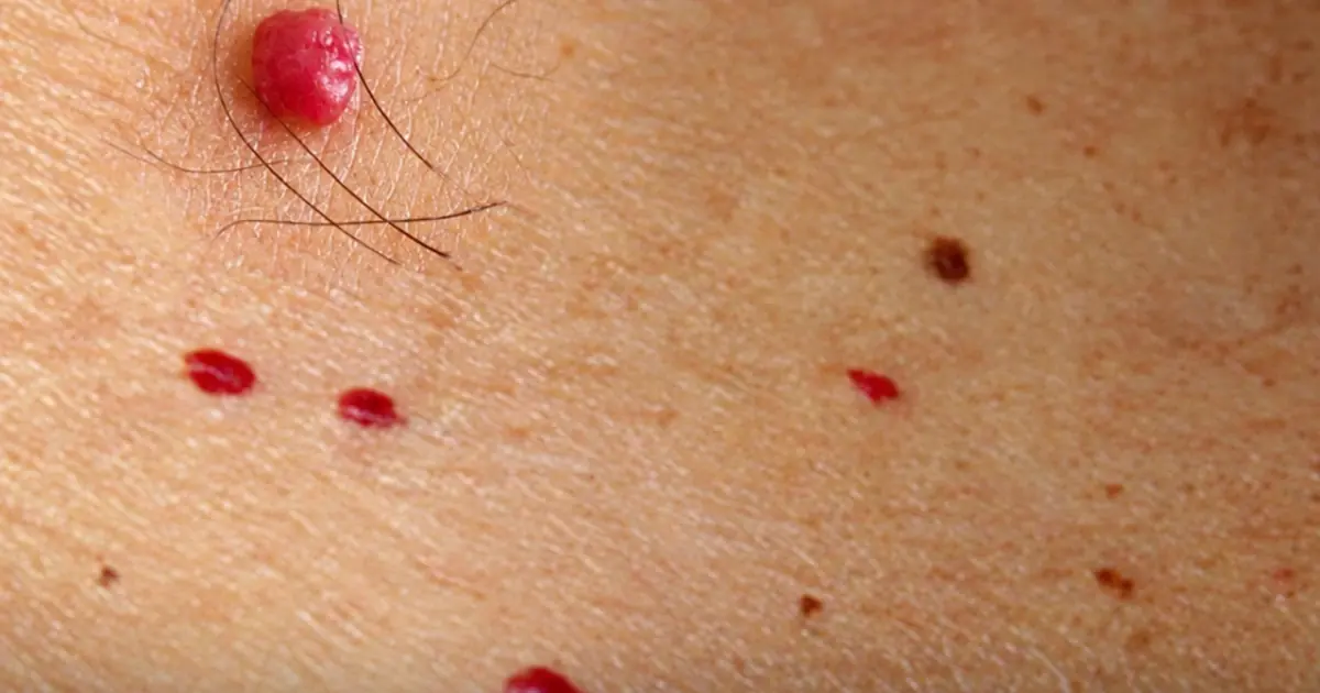 11 Reasons Why You May Have Red Dots on Your Skin