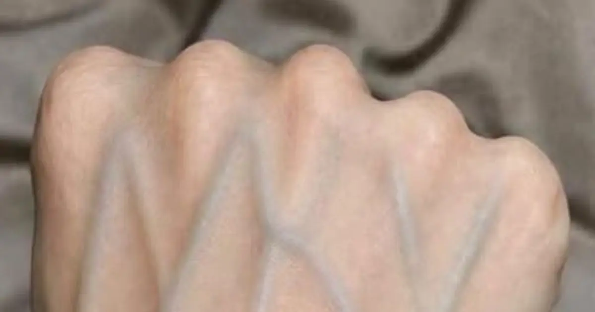 If your veins are visible in your hand, it is a signal of ca…See more