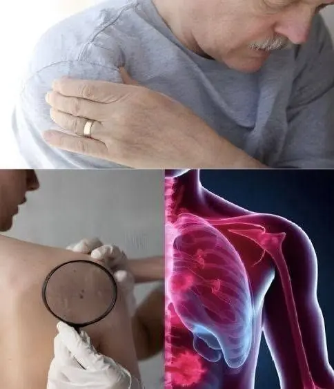 15 Early Signs Can.cer Is Growing in Your Body