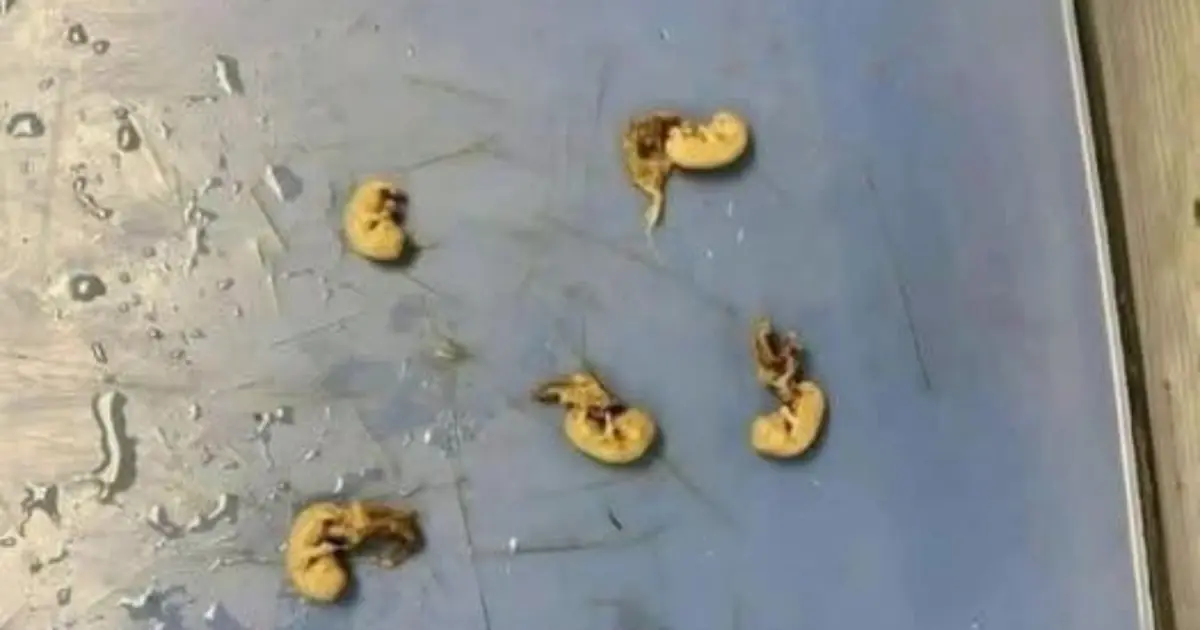 Beware the “Seeds in Your Snack”: How Hidden Threats Can Lurk in Everyday Foods