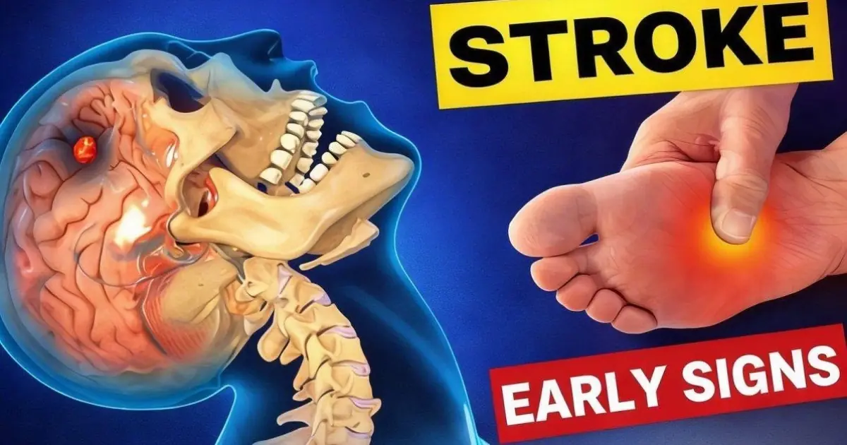 8 Warning Signs of Stroke That May Appear One Month Before