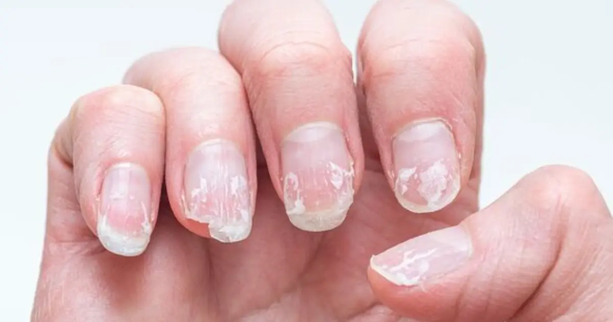 Brittle Nails and Peeling Edges? This Simple Soak May Help