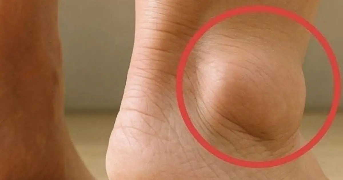 If you notice your legs are swollen, that’s a sign of ca…See more