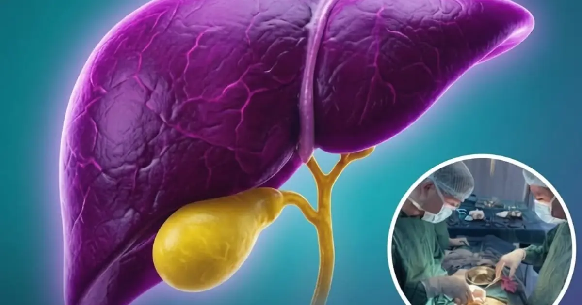 Gallbladder Removal: What Changes Can You Expect in Your Body?