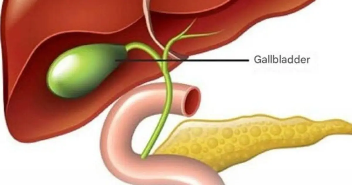 Life After Gallbladder Removal: What Really Happens to Your Body?