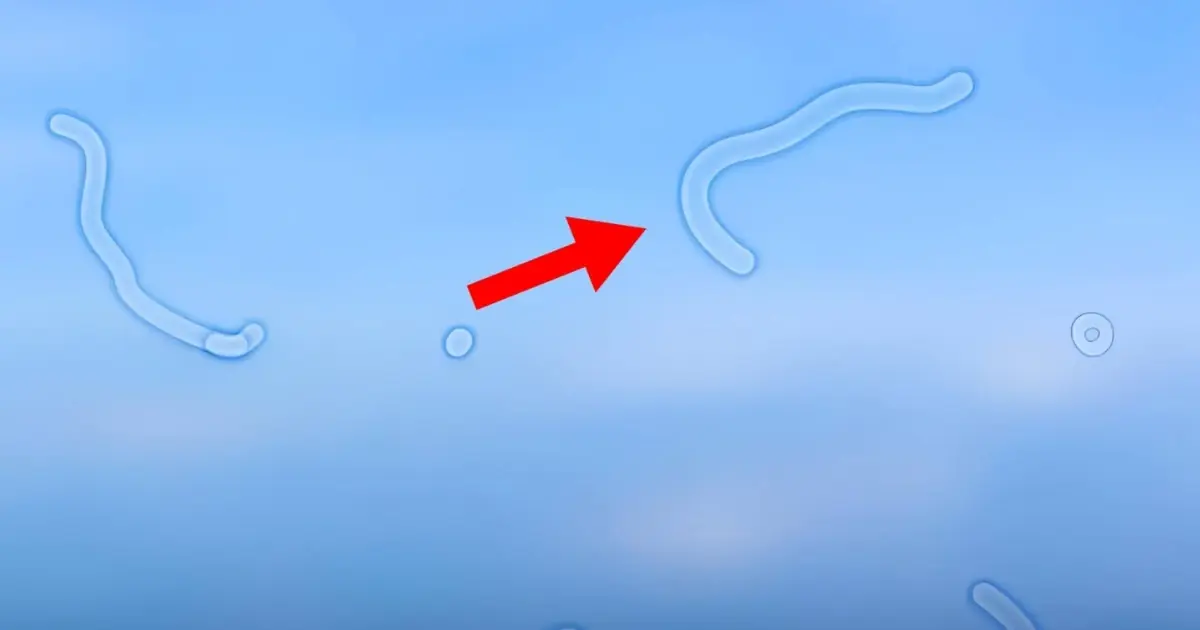 Eye Doctor Explains What To Do If You Start Seeing “Floaters”