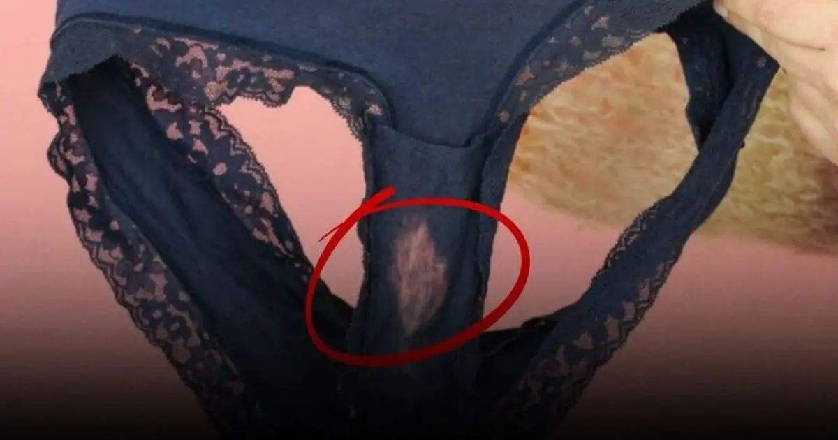 If You Find a “Bleach” Patch in Your Underwear, Here’s What It Could Mean