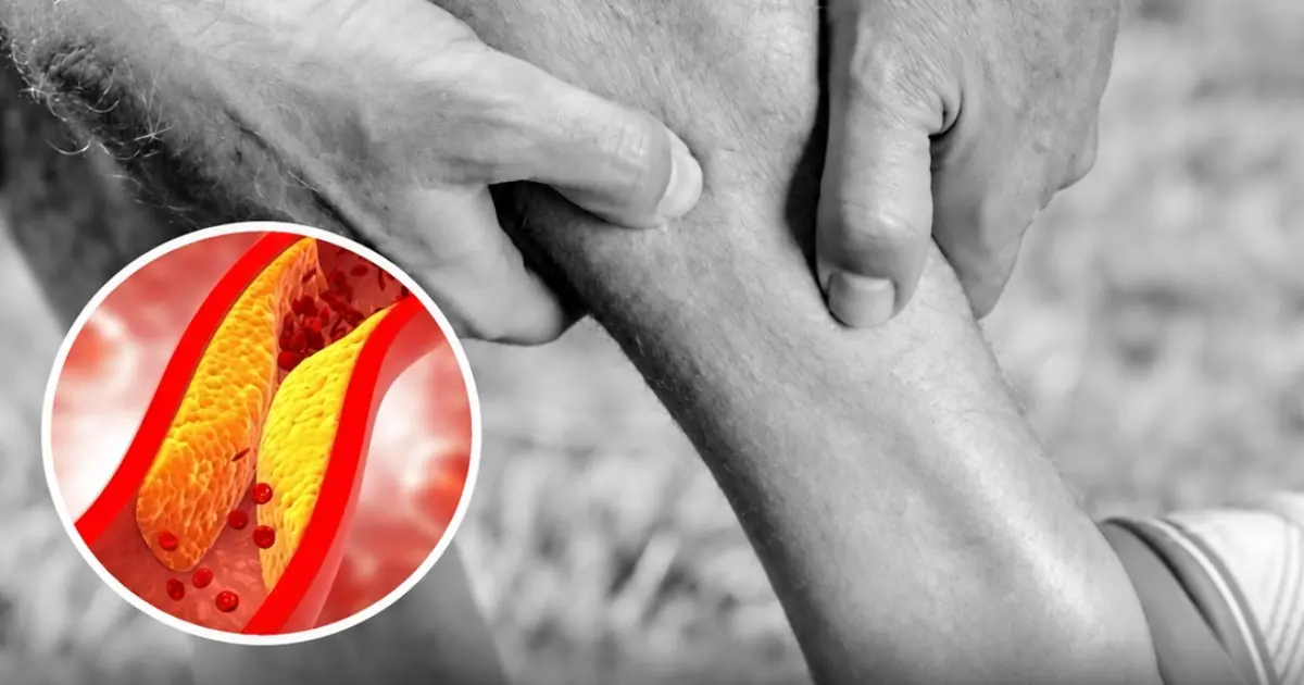 Warning Signs in Your Legs at Night: What They Could Mean for Your Heart Health