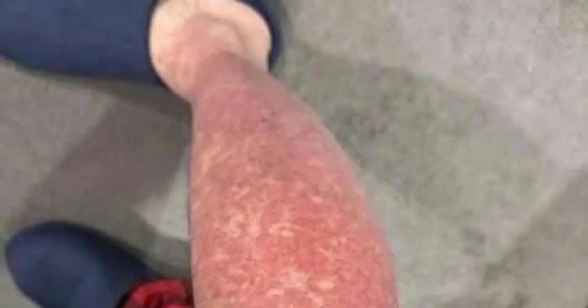 Here are the consequences of sleeping with… See more
