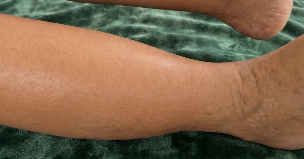 These Subtle Signs Can Reveal That Something May Be Going On Inside Your Body