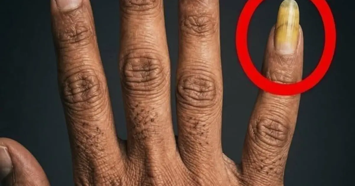 Why Do Some Men Grow One Fingernail Long? The Real Reasons May Surprise You