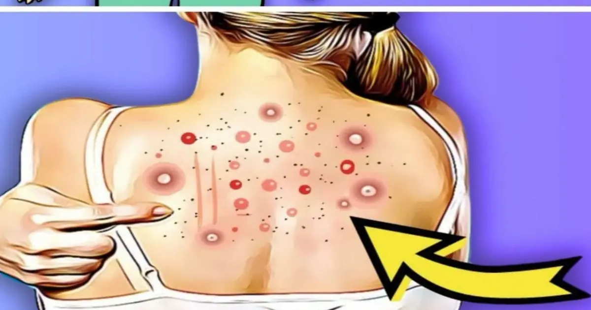 5+ Silent Symptoms of Fatty Liver You Must Never Ignore