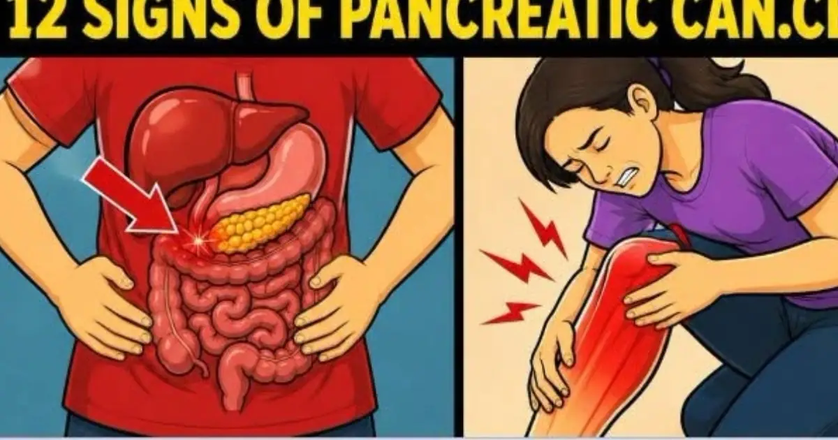 Your Body May Be Sending These 12 Pancreatic Danger Signals
