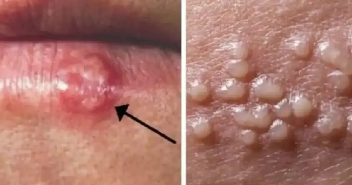 10 Subtle Warning Signs Your Body May Be Sending You
